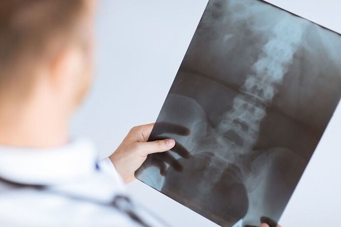 Dijagnostičke mogućnosti za lumbalnu osteohondrozu