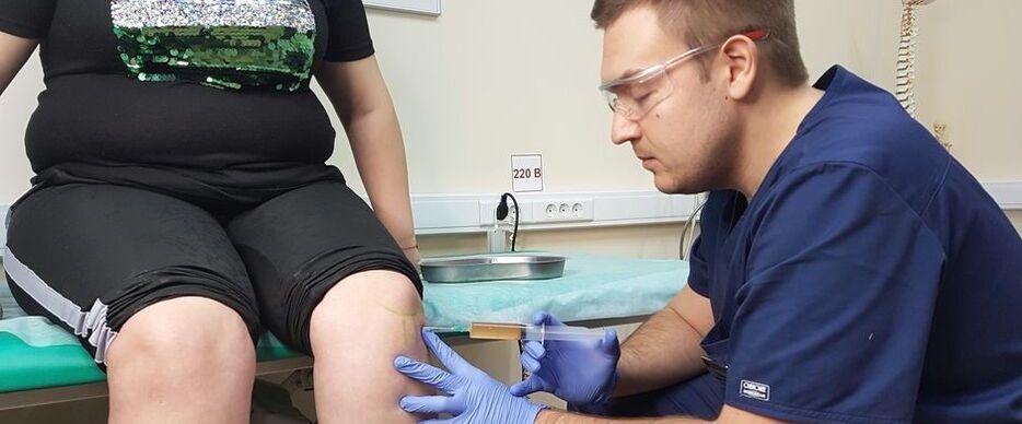 Liječnik ortoped daje intraartikularnu injekciju u zglob koljena za osteoartritis